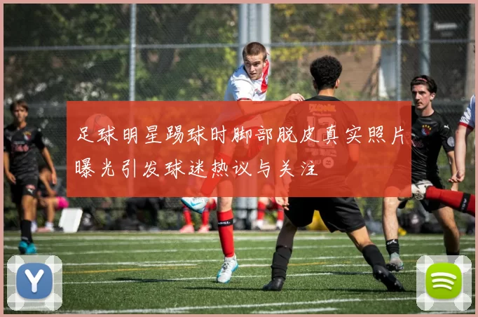足球明星踢球时脚部脱皮真实照片曝光引发球迷热议与关注